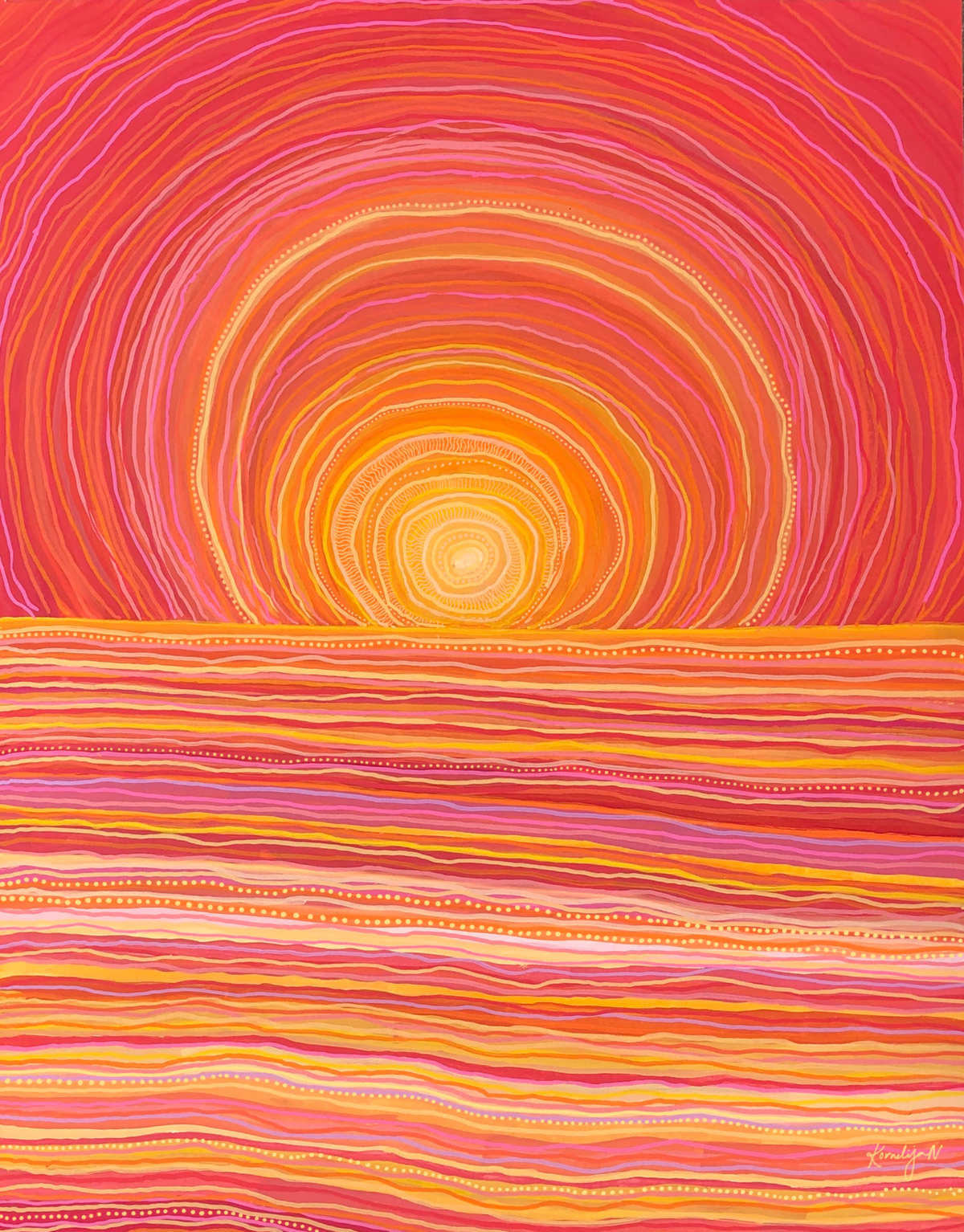 Sundown Syndrome